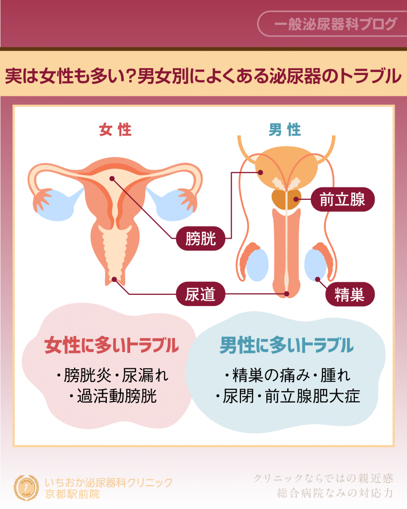 実は女性も多い？男女別によくある泌尿器のトラブル 
