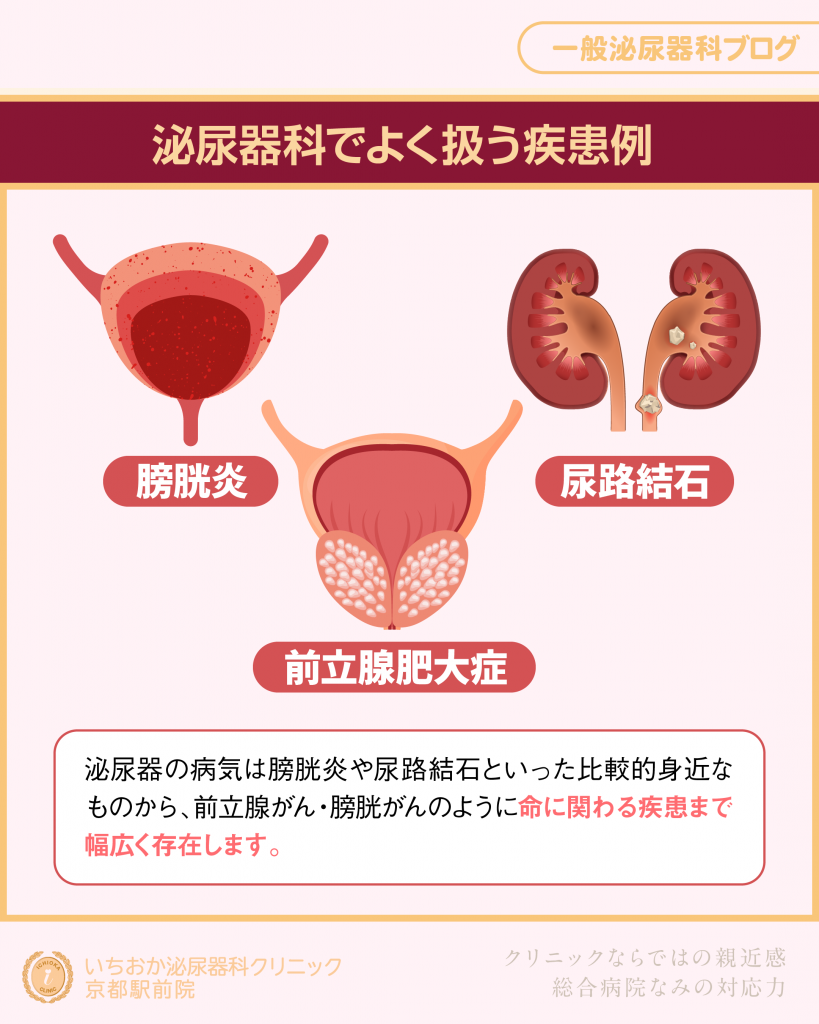 泌尿器科でよく扱う疾患例