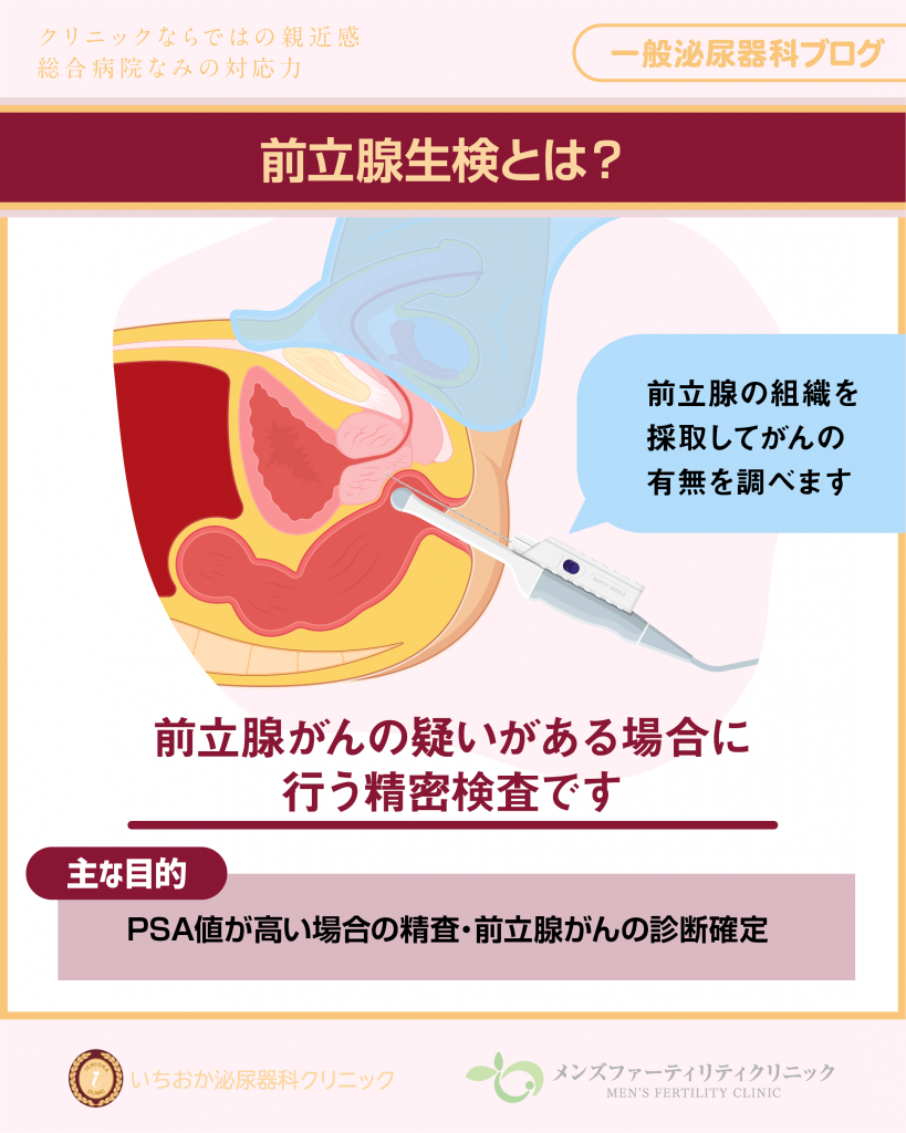 前立腺生検とは？