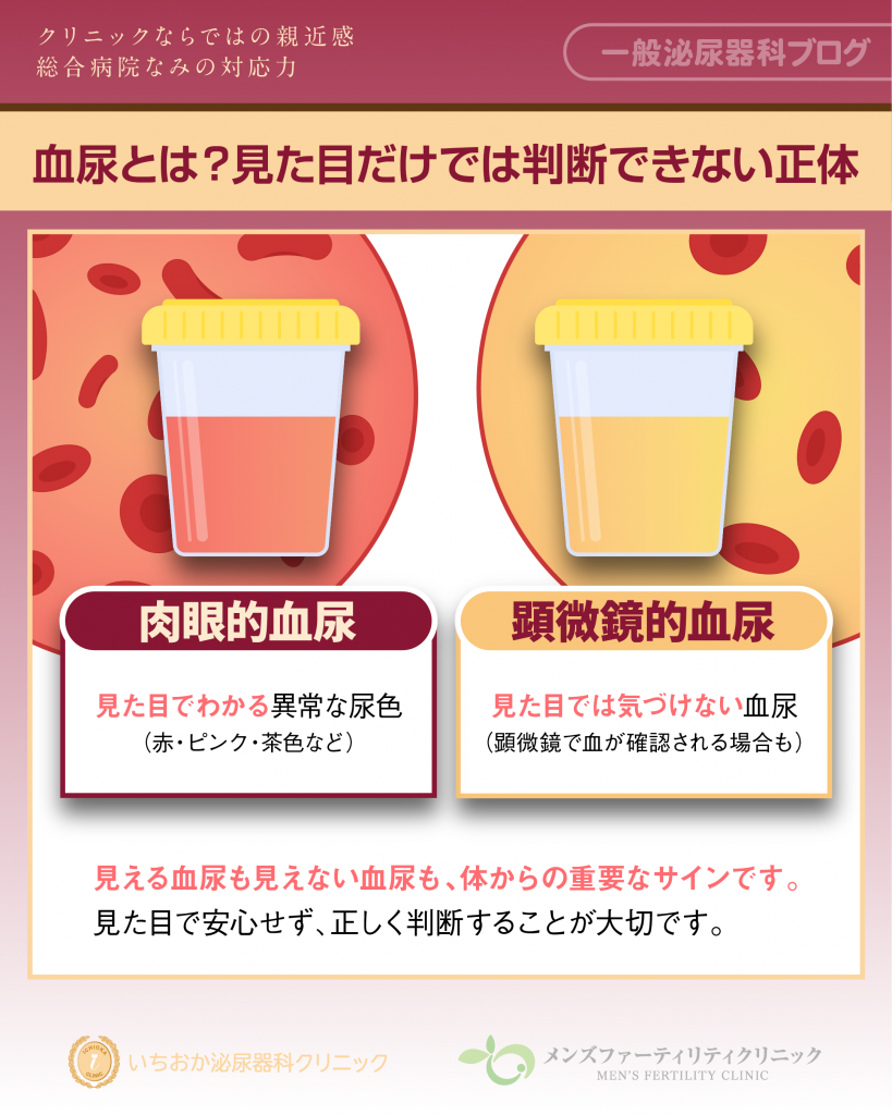 そもそも血尿とは？見た目だけでは判断できない正体