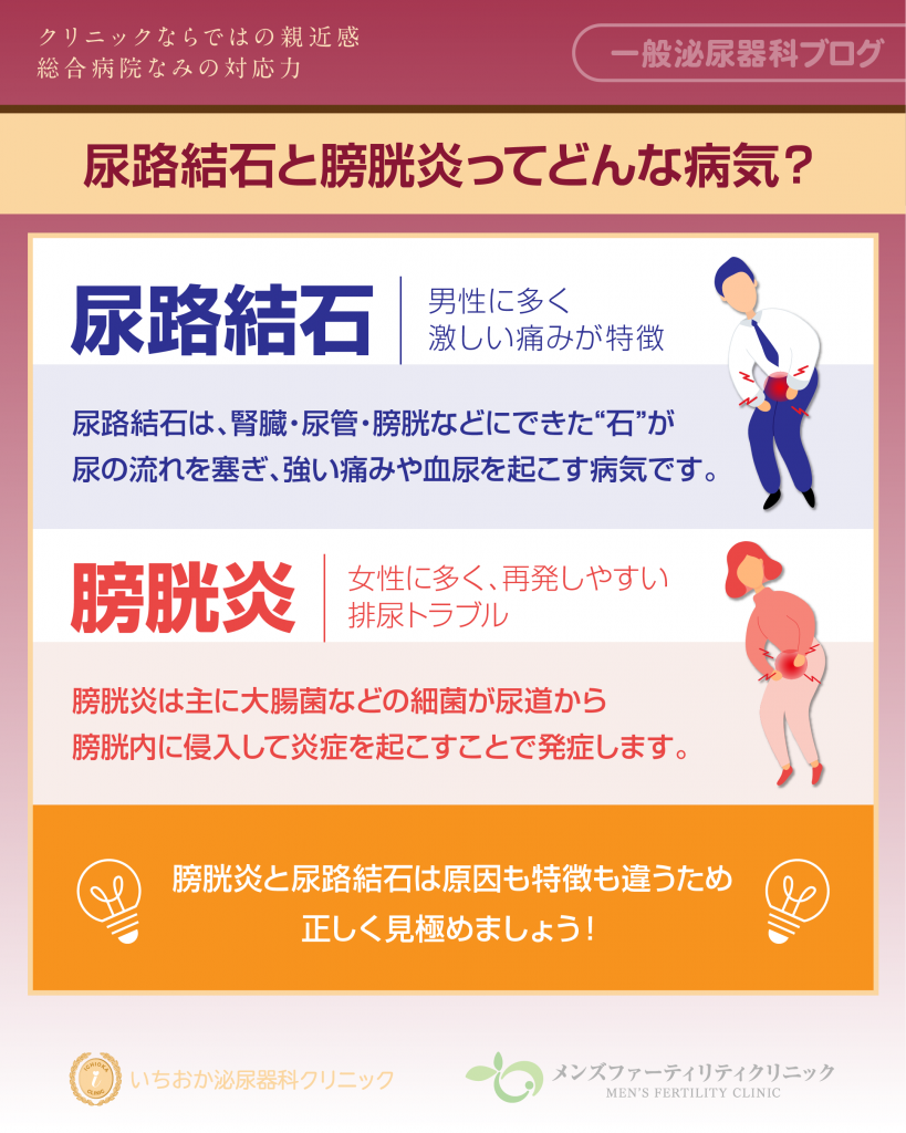  尿路結石と膀胱炎ってどんな病気？まずは基礎から