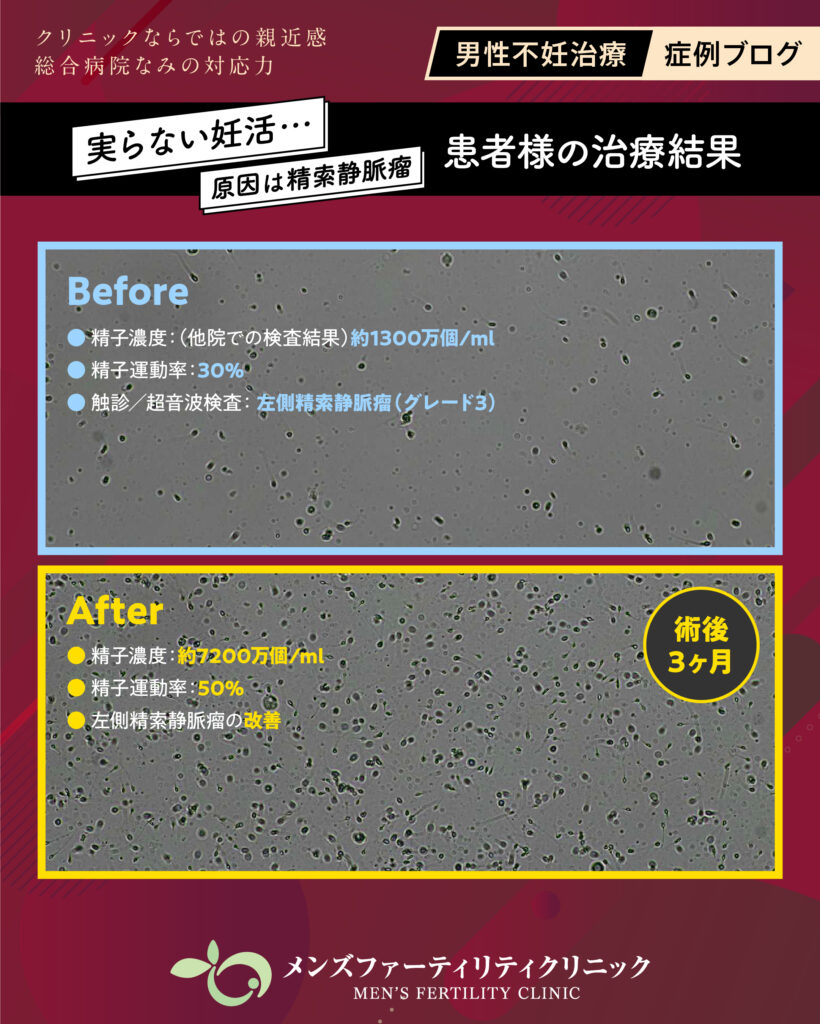 ビフォーアフター