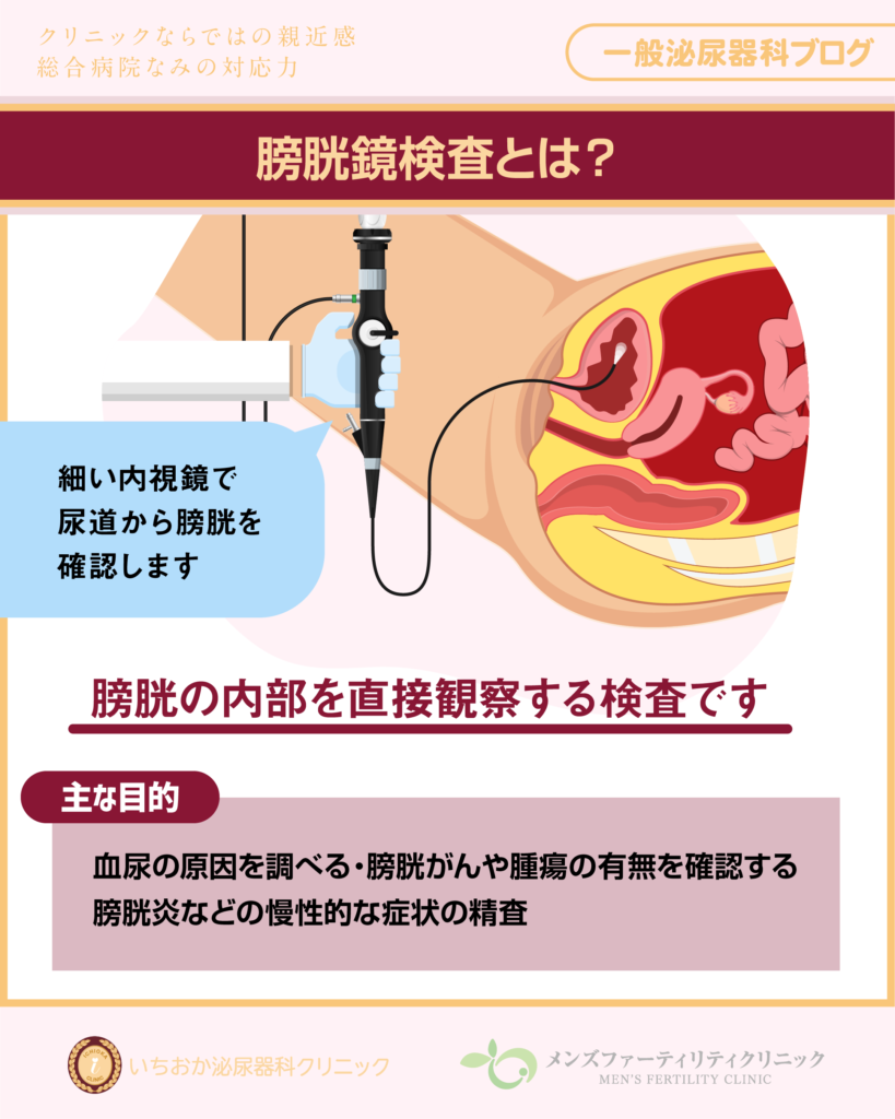 膀胱鏡検査とは?