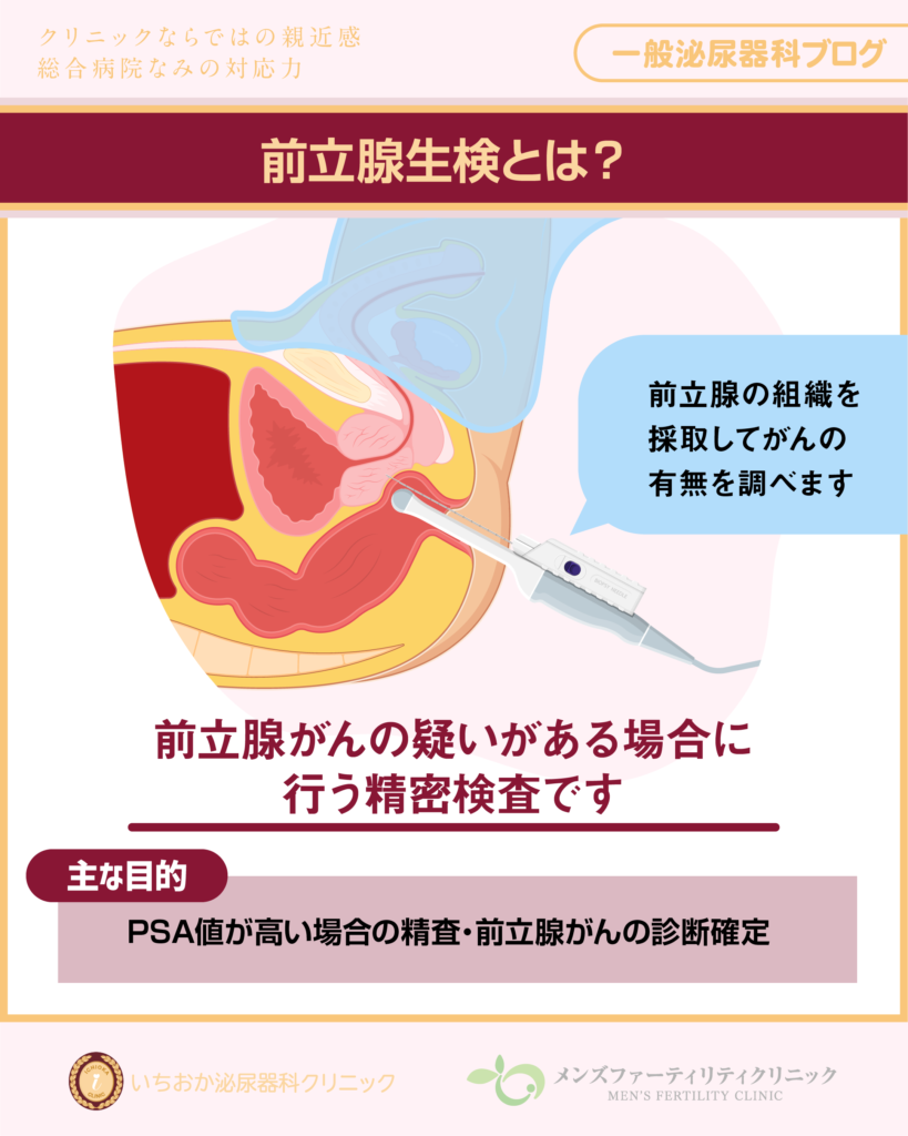 前立腺生検とは?