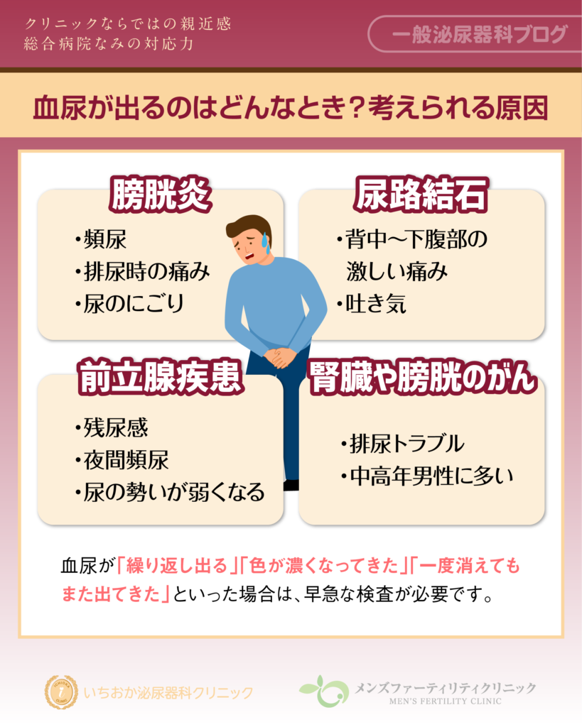 血尿が出るのはどんなとき?考えられる主な原因