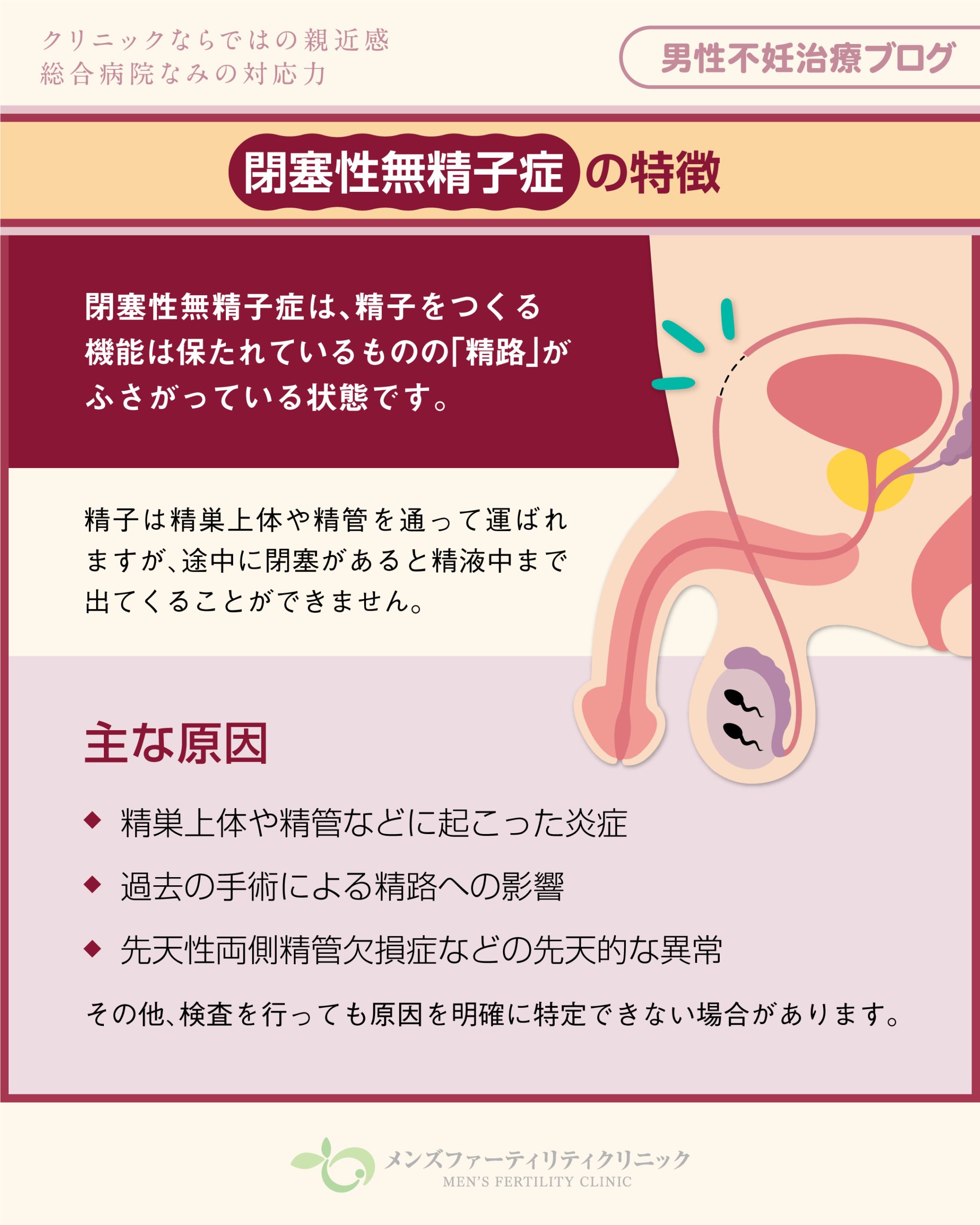 閉塞性無精子症の特徴