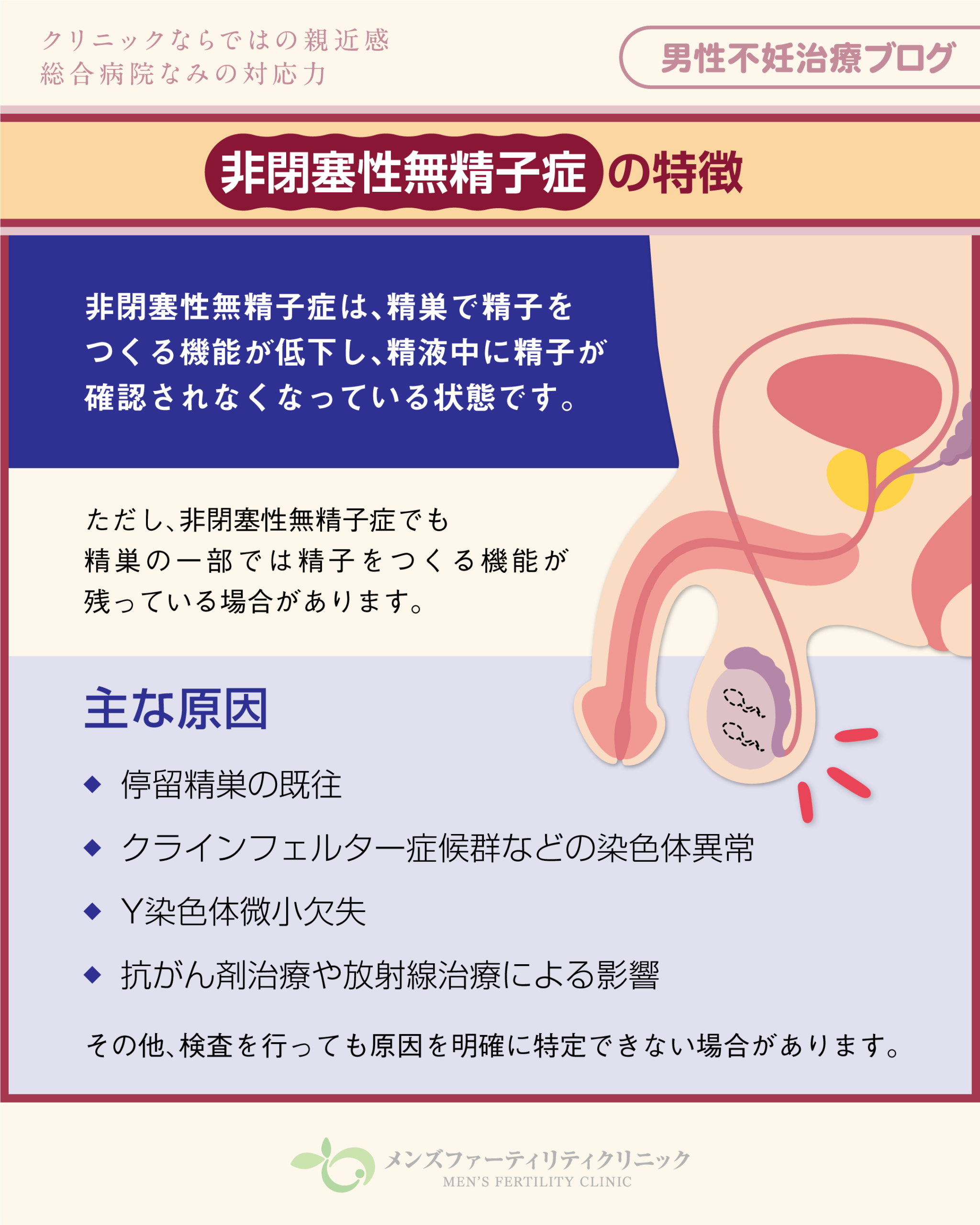 非閉塞性無精子症の特徴